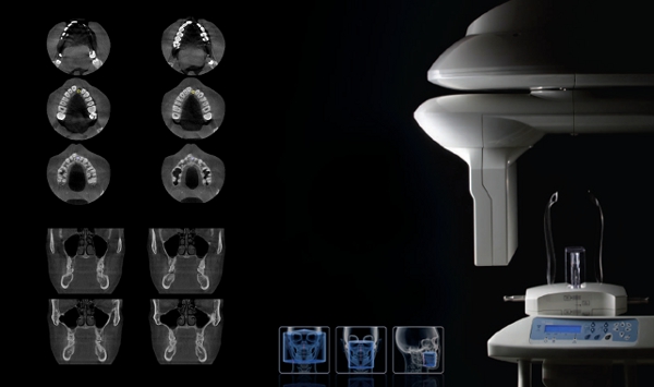 Radiographie 3d